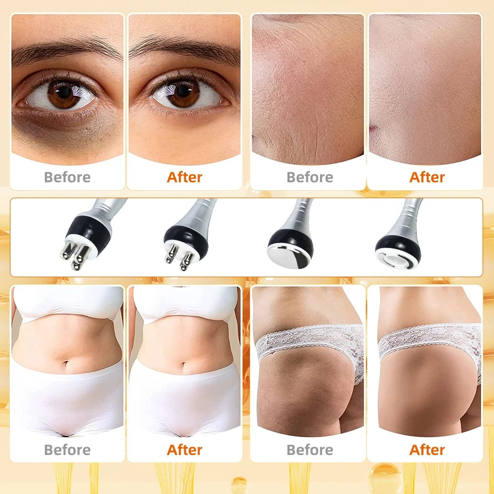 4IN1 40k Cavitation Body Slimming Machine Skin Tighten Face Lifting Vacuum Suction